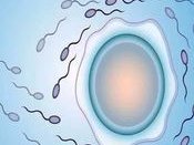 22号染色体三体是什么意思？染色体异常试管要注意什么？